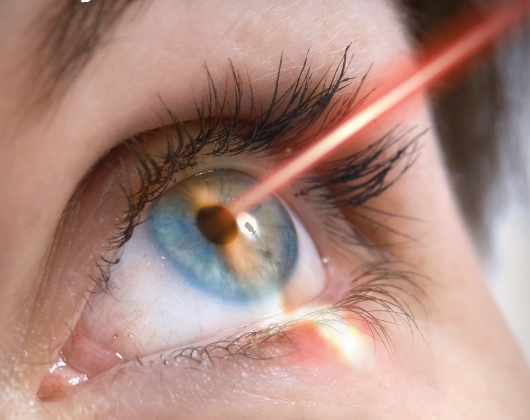 Finding the Best Clinics for Laser Eye Surgery in Europe