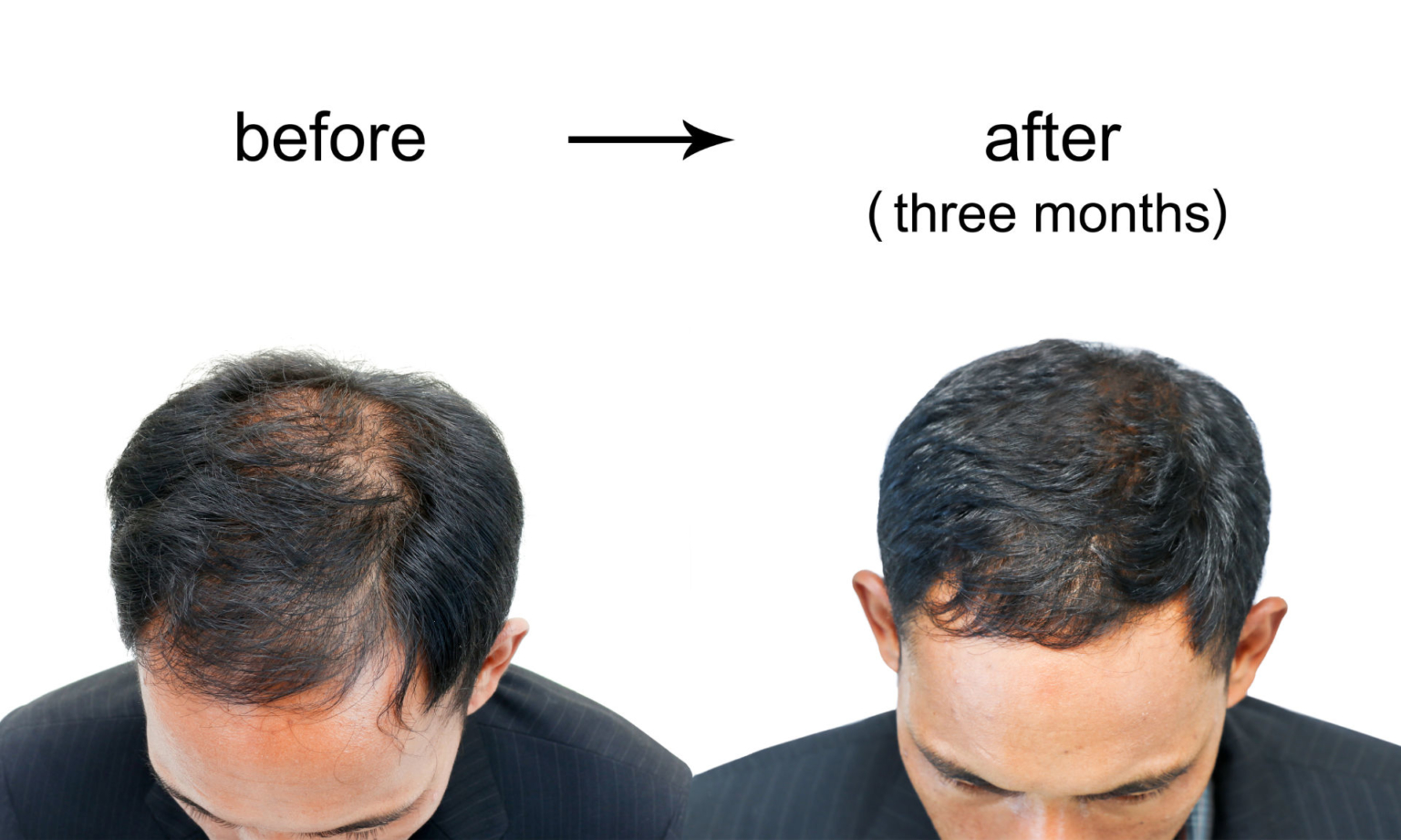 Where to Find the Best Trichology Clinics in Europe for Hair Loss Treatment