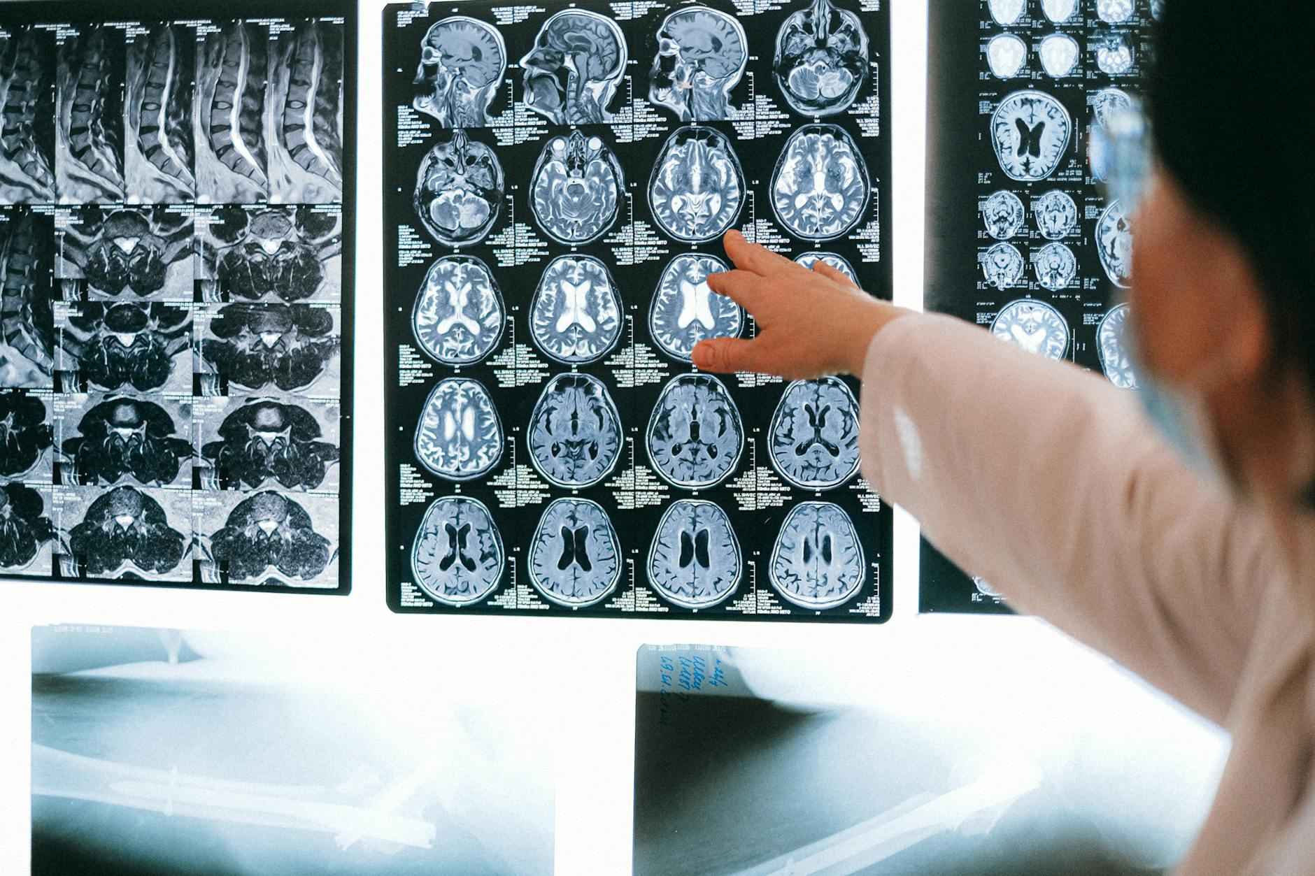 Qu'est-ce qu'une clinique sans rendez-vous ?