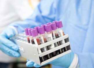 Inloopkliniek nu open: waar kun je direct geholpen worden? Inloopkliniek nu open: waar kun je direct geholpen worden?