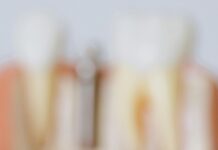 Dental Implants Abroad Helvetic Clinics: Why Choose Them Today?