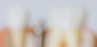 Dental Implants Abroad Helvetic Clinics: Why Choose Them Today?