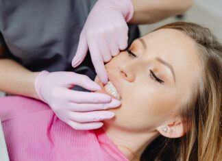 Gum Clinic Secrets: How Expert Care Transforms Your Smile