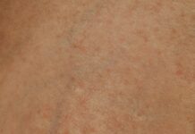 Swiss Clinic Secrets: How To Transform Your Skin Naturally