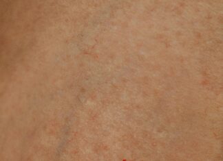 Swiss Clinic Secrets: How To Transform Your Skin Naturally