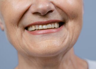 Clinica Dental Secrets: How To Achieve A Radiant Smile Naturally