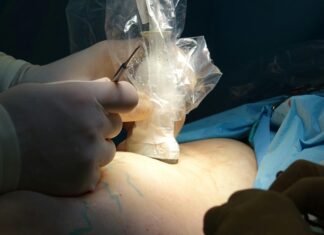 Pinehurst Surgical Clinic: Discover Expert Care and Advanced Treatments