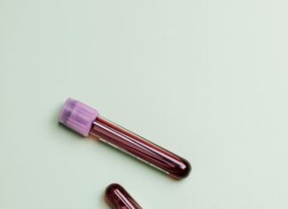 Clinical Pathology Explained: Unlocking Secrets Behind Disease Diagnosis