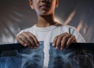 Mayo Clinic Symptom Checker: Discover Accurate Health Insights Today